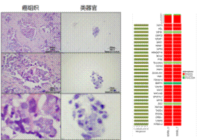 医学药筛新变革｜世界首例由实体瘤癌症患者为来源的类器官，成功筛选到临床候选药物！