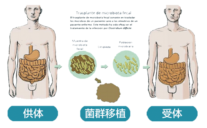 禁食减肥易诱发感染：如何使用FMT科学减肥，改善肠道？